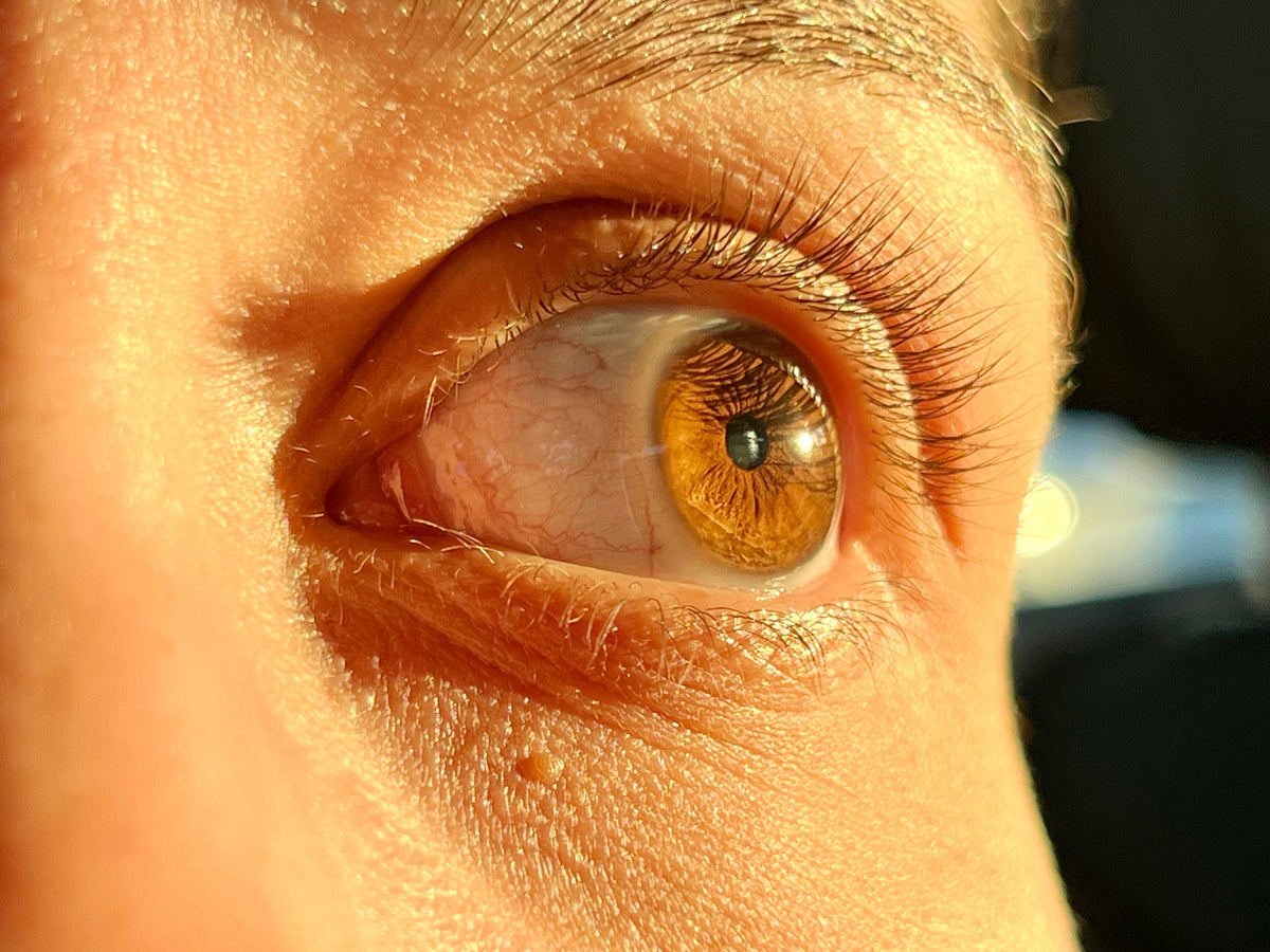 Detailed close-up of a human eye in direct sunlight, illustrating the potential long-term effects of UV damage on eye health.